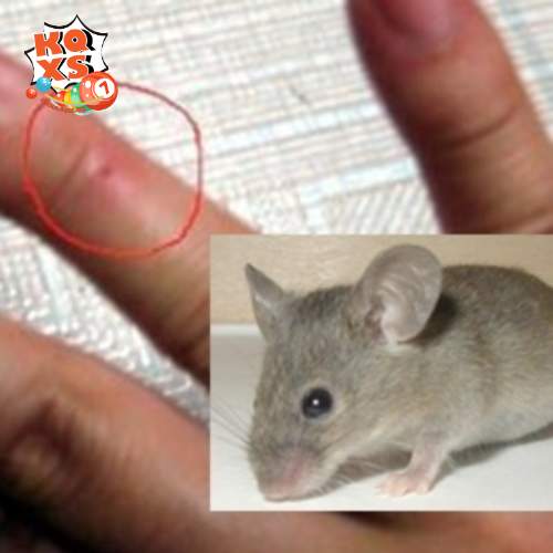 Gặp giấc mộng chuột cắn gây chảy máu