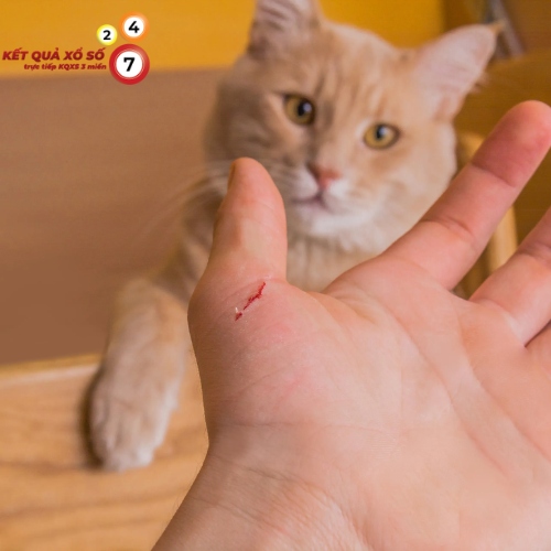 Đặt lại ranh giới, tránh bị lạm dụng
