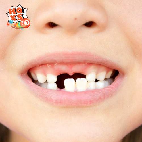 Con số gợi ý khi mơ thấy rụng răng có thể mang đến may mắn